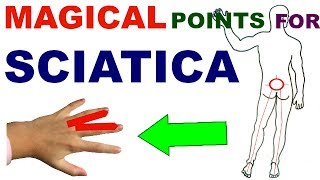 Sujok Therapy For SciaticaSujok Points For SciaticaSujok Acupressure Points For Sciatica [upl. by Annairba418]