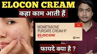 elocon cream  for dark spots  ke fayde  kaise use kare  use in hindi [upl. by Hayila]