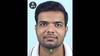 Best Hair Transplant in Udaipur I Amazing Hair Transplant Result in Udaipurudaipurhairtransplant [upl. by Newman]