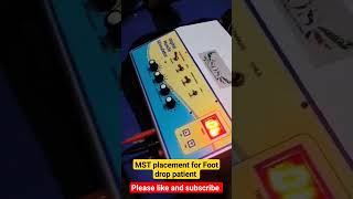 foot drop muscle stimulator placement physiotherapyhealthylifestyle [upl. by Tibbs944]