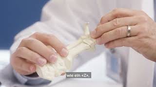 Sprechstunde mit Urs Neurauter Hallux valgus [upl. by Aral]