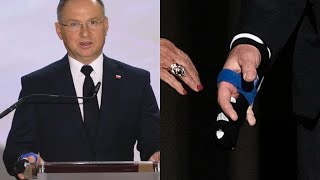 Andrzej Duda kontuzjowany Co na to lekarz quotNie był to mały urazquot [upl. by Suzanna413]