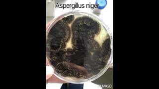 Aspergillus niger fungus growth on sabouraud dextrose agar SDA [upl. by Nuahsed49]