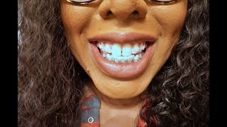 Braces Update  Worst Week Ever  Adult Braces Journey Week 1 [upl. by Anuahsar816]