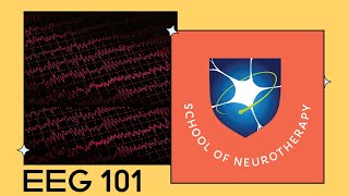 EEG 101 [upl. by Howlond762]