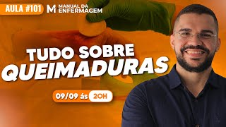 TUDO QUE VOCÊ PRECISA SABER SOBRE QUEIMADURAS  VIDEO AULA 101 [upl. by Moht]