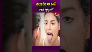 నాలుక మీద ఇలా ఉంటే నాలుక క్యాన్సరేనా shorts cancer tonguecancer hmtvhealthplus [upl. by Araminta]