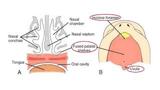 Development of the palate  Dr Ahmed Farid [upl. by Palma]