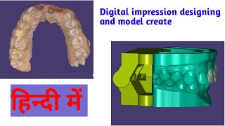 How to design basal implant in exocadHow To Design A Case With Digital ImpressionIntraoral Scanner [upl. by Naiviv]