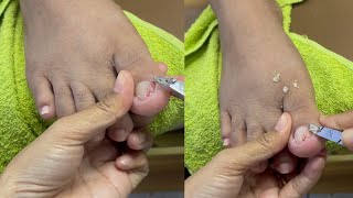 The Dangerous Nail Habit Thats Ruining Your Ear Health មកយឺតហើយ😂 nail​​​ asmr fyp ear shorts [upl. by Etienne]