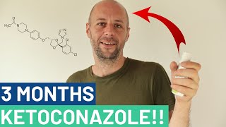 Ketoconazole Shampoo Experiment As Good As Minoxidil [upl. by Enalb]