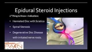 5 Things to Know About Epidural Steroid Injections 602 5076550 [upl. by Cressler]