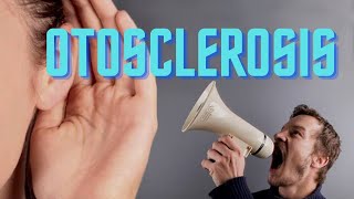 Otosclerosis  Otospongiosis  ENT Lecture [upl. by Aeel]