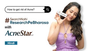 Acne problem SearchNahiResearchPeBharosa with AcneStar Gel  RaashiiKhannaOfficial  Hindi [upl. by Eylloh]