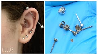 Removing Gunky Tarnished Jewelry From Her Ear  S4 EP23 [upl. by Maisey]