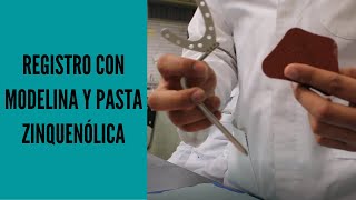 ✅Registro con MODELINA y PASTA ZINQUENÓLICA🦷Montaje en articulador semiajustable Whip Mix 8500 [upl. by Venus916]