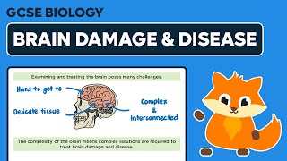 Treating Brain Damage amp Disease  GCSE Biology [upl. by Janek932]