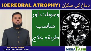 Cerebral Atrophy in Urdu  Demagh ki sukran [upl. by Znarf309]