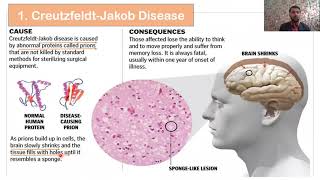 Types of Prions Diseases  Prions diseases in Animals and Human  Part 02 [upl. by Garald]