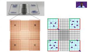 Counting cells on a hemocytometer [upl. by Rozalin]