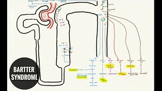 BARTTER SYNDROME and LOOP DIURETICS [upl. by Zahavi]