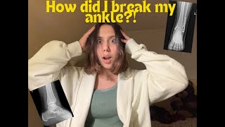 My broken ankle journey ORIF ankle surgery recovery [upl. by Dorsman]