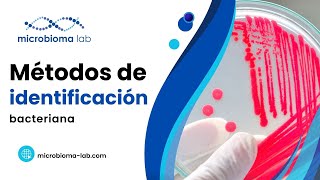 🦠🧫 ¿Qué TÉCNICAS existen para IDENTIFICAR BACTERIAS 🦠🧫 [upl. by Graner844]