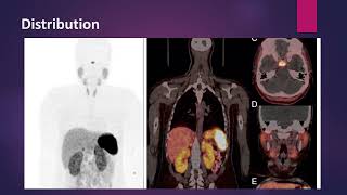 Neuroendocrine Tumors imaging with Ga 68 Somatostatin analogs MCQ nuclearmedicineMCQ [upl. by Gnahk403]