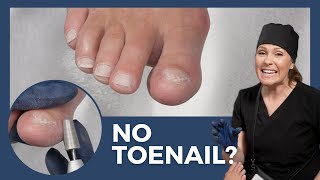 Dry Pedicure with NO TOENAIL  Cuticle Care Nail Trimming Callus Exfoliation [upl. by O'Driscoll]