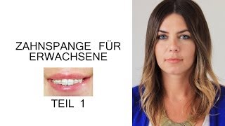 Zahnspange für Erwachsene  Der erste Schritt [upl. by Denice13]