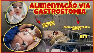 ALIMENTAÇÃO VIA GASTROSTOMIA  Como administrar a dieta pela gtt  CIRURGIA DE GTT PELO SUS [upl. by Sherard]