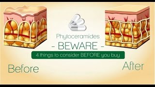 Phytoceramides BEWARE4 things to consider before buying [upl. by Enirahtak]