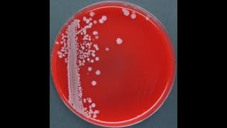 Actinobacillus lignieresii 2 [upl. by Romeu567]