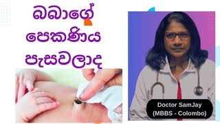 බබාගේ පෙකණිය පැසවීම හර්නියා  ග්‍රැනුයුලෝමා👶New born baby’s umbilical stump [upl. by Imat]