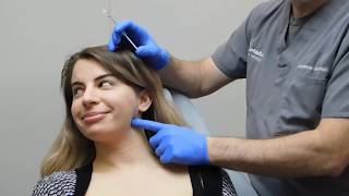 Defining the Jawline with Dysport  Botox with Dr Janowski [upl. by Temme]