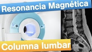 Resonancia magnética Lumbar  Cuándo y cómo se realiza [upl. by Kinna]