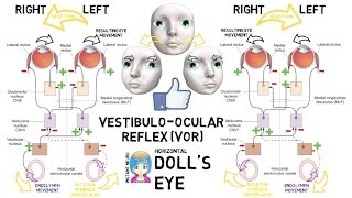 INSTANT NEURO  Dolls Eye [upl. by Fine]