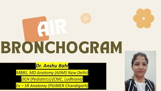 Air Bronchogram Chest X Ray Pediatrics Radiology Dr Anshus MBBS Lectures [upl. by Kcirdnek]