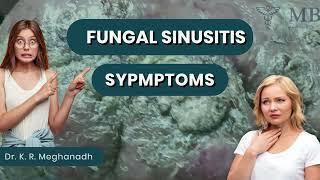 Fungal sinusitis symptoms  Dr K R Meghanadh  Medyblog [upl. by Lanuk459]