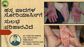 How To Cure Palmoplanter Psoriasis  Home Remedies for Palmoplanter Psoriasis  DR VINAYAK HEBBAR [upl. by Araz762]