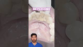 Teeth Cleaning Explained [upl. by Isteb]