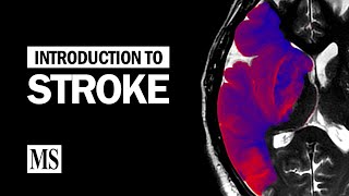 Introduction To Stroke [upl. by Tham169]