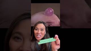 Dr Pimple Popper Explains Forehead Growth [upl. by Palm]