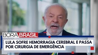 quotPode matarquot As pesquisas dos brasileiros sobre hemorragia cerebral após cirurgia de Lula [upl. by Atrice713]