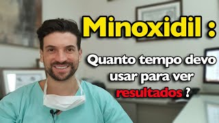 Minoxidil quanto tempo devo usar para ter resultado [upl. by Ling971]