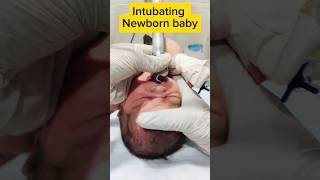 Intubating a newborn baby ytshorts nursing baby shorts youtubeshorts new trending viral [upl. by Husha]