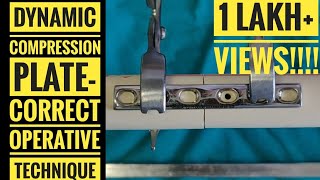 Dynamic Compression Plate DCP Correct Operative Technique [upl. by Eipper]