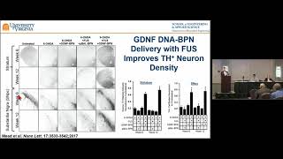 MR ImageGuided Transfection of the CNS with Focused Ultrasound and BrainPenetrating Nanoparticles [upl. by Banquer166]