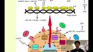 A Novel Form of Cancer Therapy Targeting Metastatic EMT [upl. by Jacki]