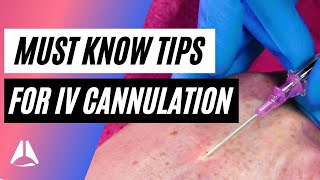 Important tips and tricks for IV cannulation [upl. by Woodruff]